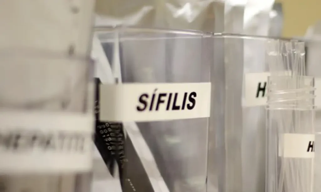 Centro de SP tem testagem grátis de HIV, hepatite, síflis e gonorreia