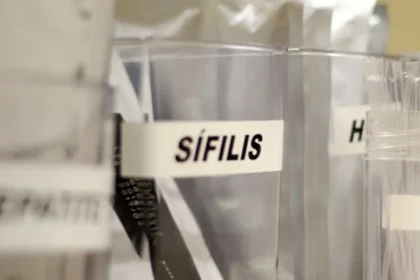 Centro de SP tem testagem grátis de HIV, hepatite, síflis e gonorreia