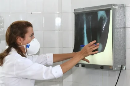 OMS recomenda testes de diagnóstico rápido para erradicar tuberculose