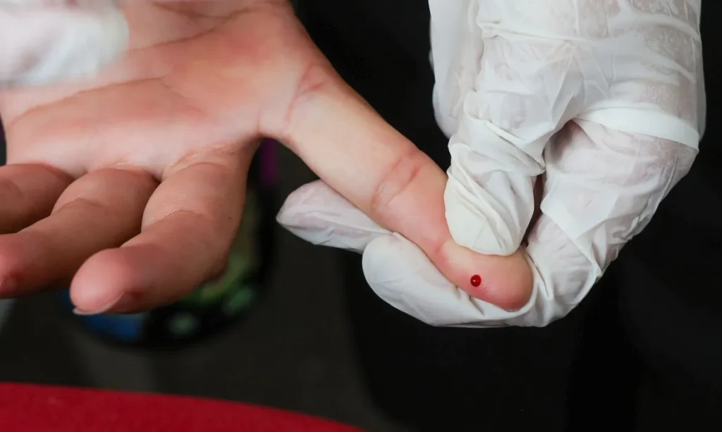 Teste rápido de dengue passa a integrar tabela do SUS